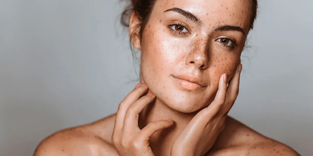 Visage d'une jeune femme aux taches brunes naturelles, ses mains caressant délicatement sa peau.