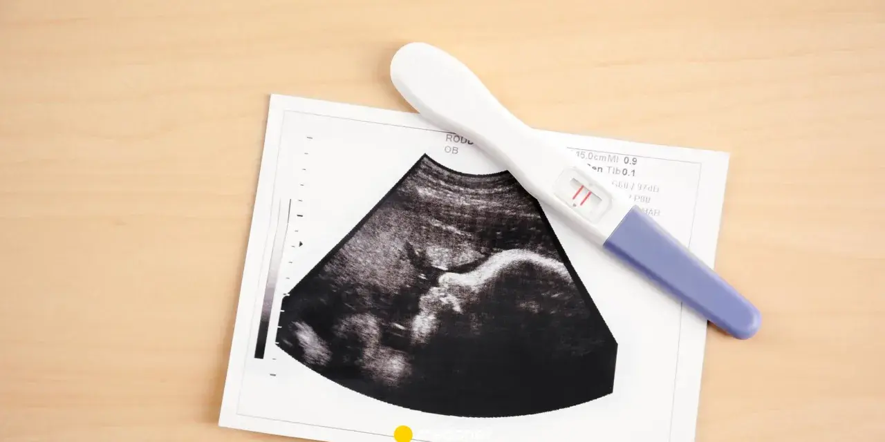 USG pokazuje pęcherzyk ciążowy, a obok leży pozytywny test ciążowy.