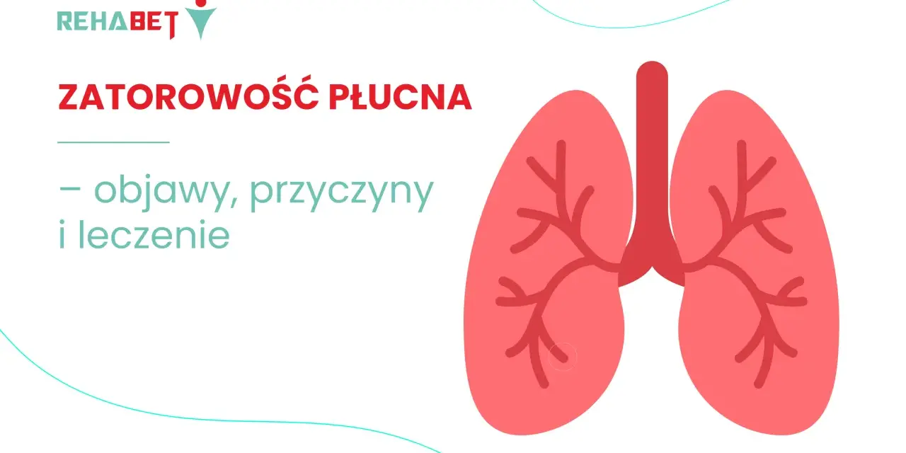 Zatorowość płucna: objawy, przyczyny i leczenie. Grafika przedstawia stylizowane płuca.