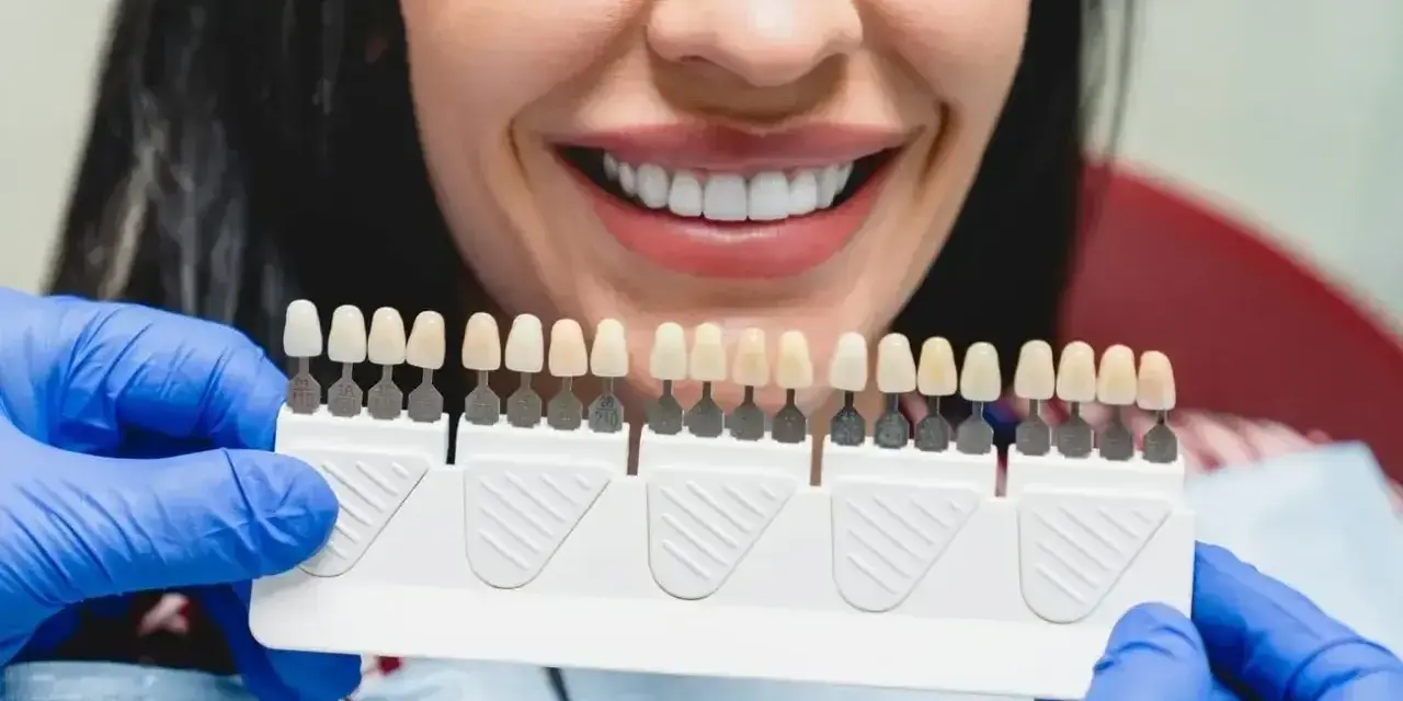 Uśmiechnięta kobieta z paletą odcieni zębów w rękach dentysty w niebieskich rękawiczkach.