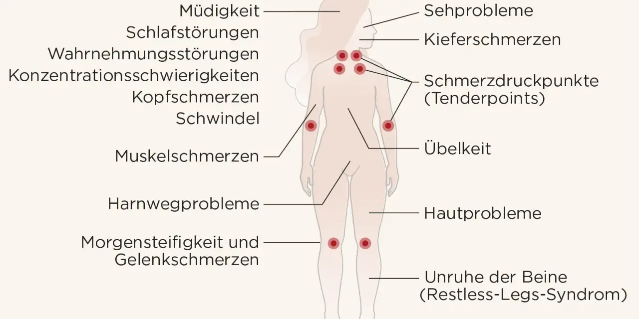Fibromyalgie symptome: Müdigkeit, Schlafstörungen, Kopfschmerzen, Muskelschmerzen, Übelkeit, Hautprobleme, Sehprobleme, Kiefer- und Gelenkschmerzen, Konzentrationsschwierigkeiten, Schwindel, Harnwegsprobleme, Morgensteifigkeit, Unruhe der Beine.