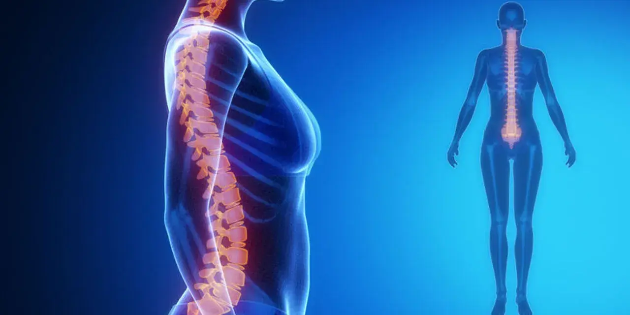 Anatomia kręgosłupa z widoczną lordozą lędźwiową spłyconą.