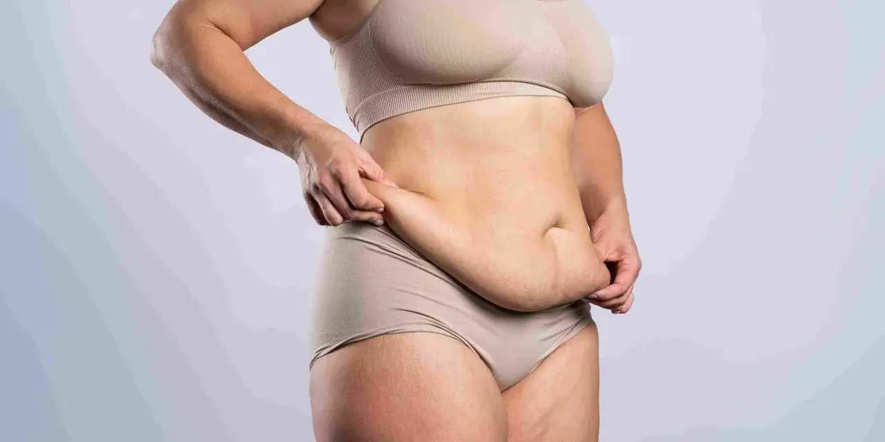 Kobieta w bieliźnie pokazuje fałdy brzuszne, rozważając abdominoplastykę.