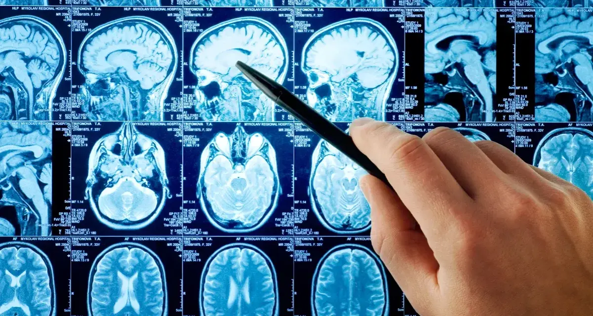 Jakie choroby psychiczne wykryje rezonans magnetyczny głowy i jak to działa