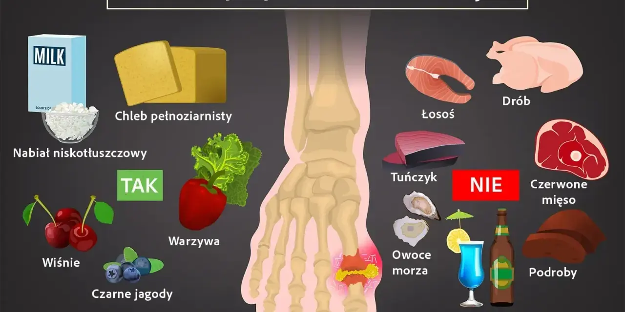Dieta przy dnie moczanowej: nabiał, chleb pełnoziarnisty, warzywa, wiśnie, jagody – TAK. Unikaj: łososia, drobiu, tuńczyka, czerwonego mięsa, podrobów, owoców morza, alkoholu.