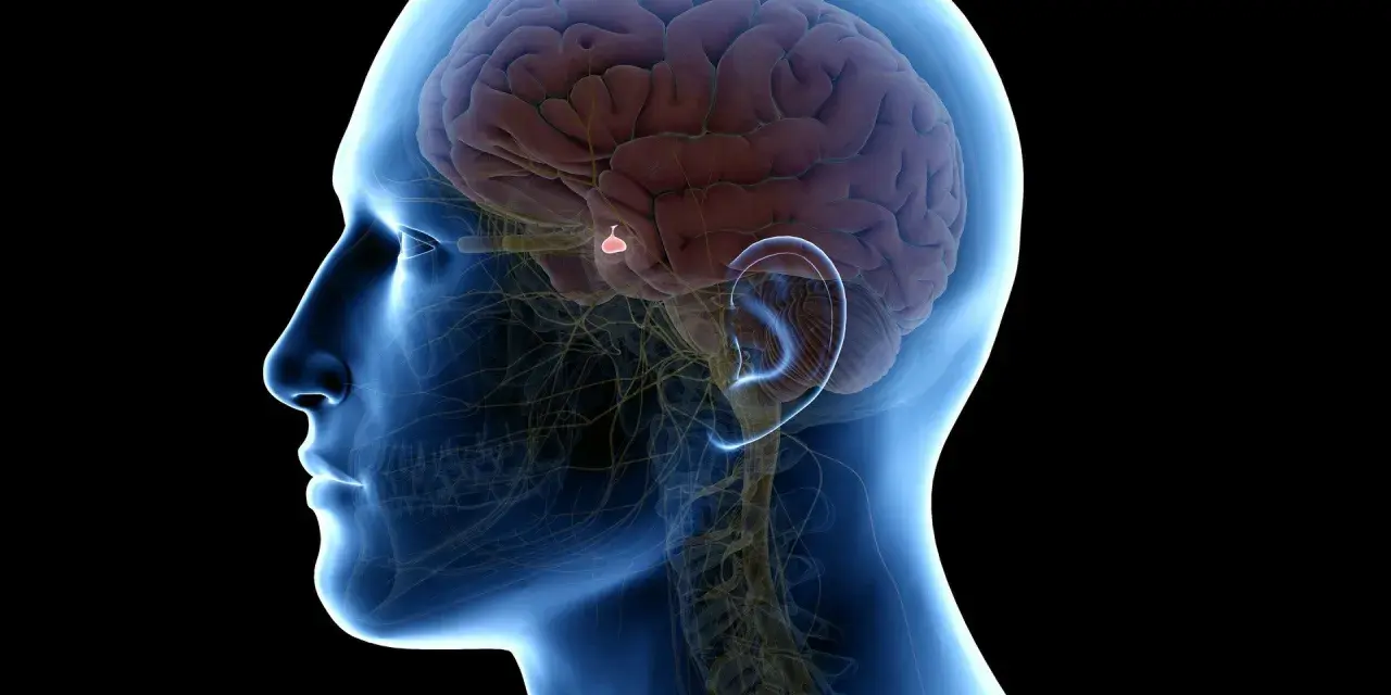 Anatomia mózgu z zaznaczonym guzem przysadki mózgowej. Choć rzadko, guz przysadki mózgowej może prowadzić do poważnych konsekwencji, a nawet śmiertelności.