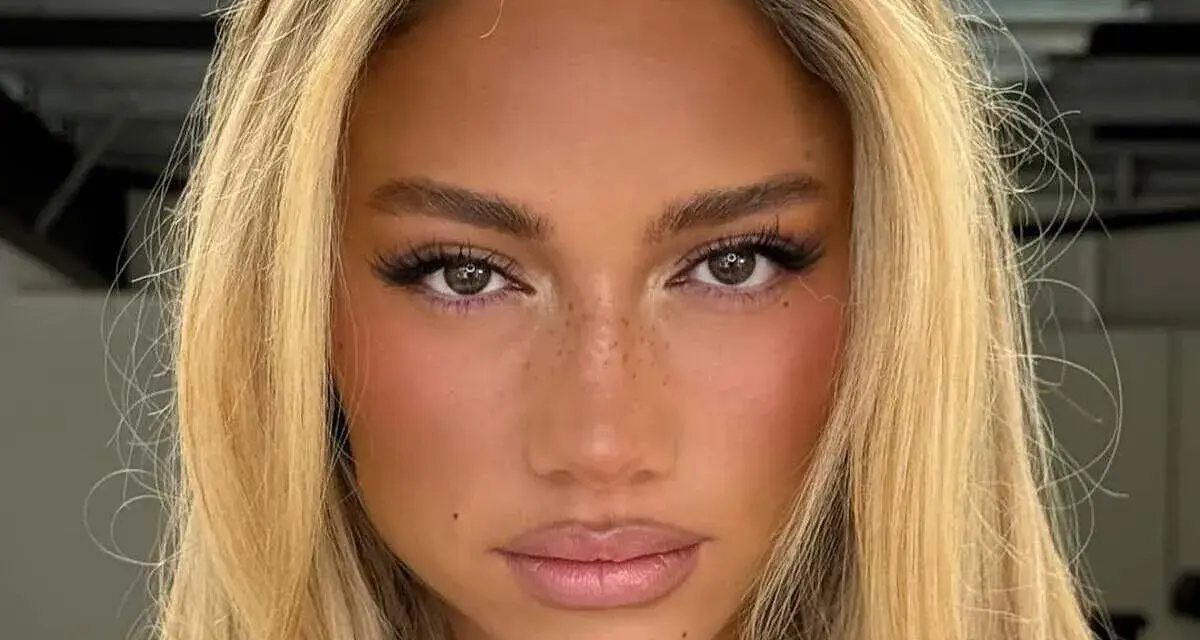 Primer plano de una mujer con cabello rubio y ojos separados, pecas sutiles y labios rosados.