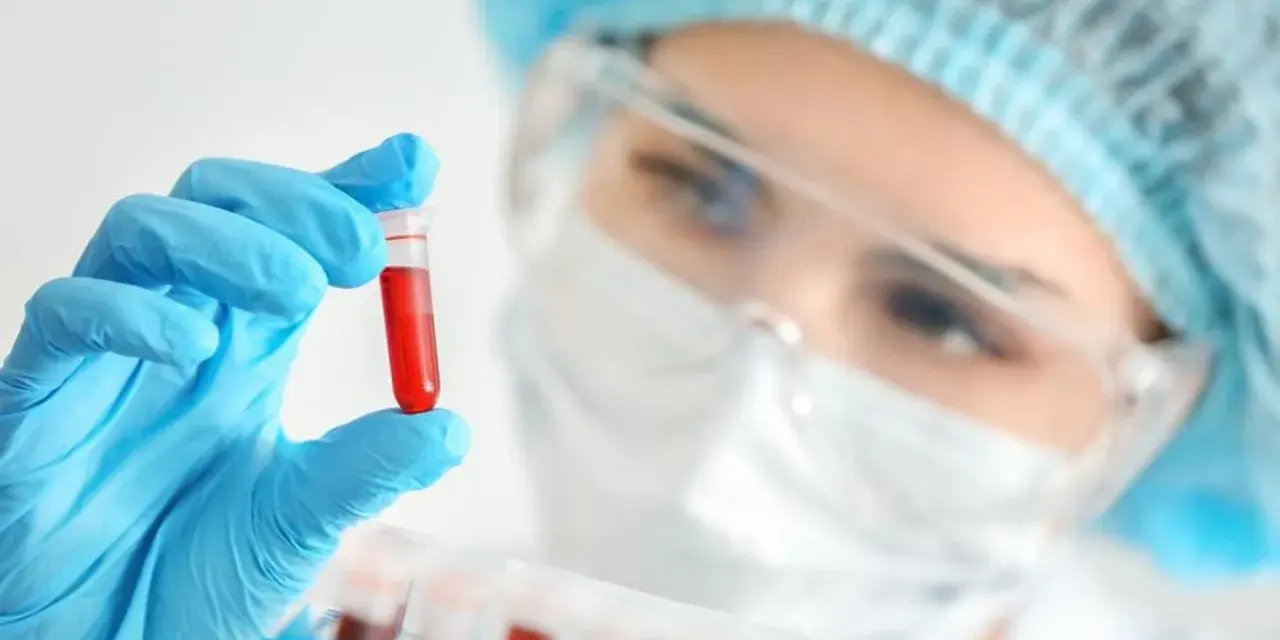 W laboratorium mikrobiologicznym analizuje się próbki, jak ta z krwią, by wykryć i badać mikroorganizmy.