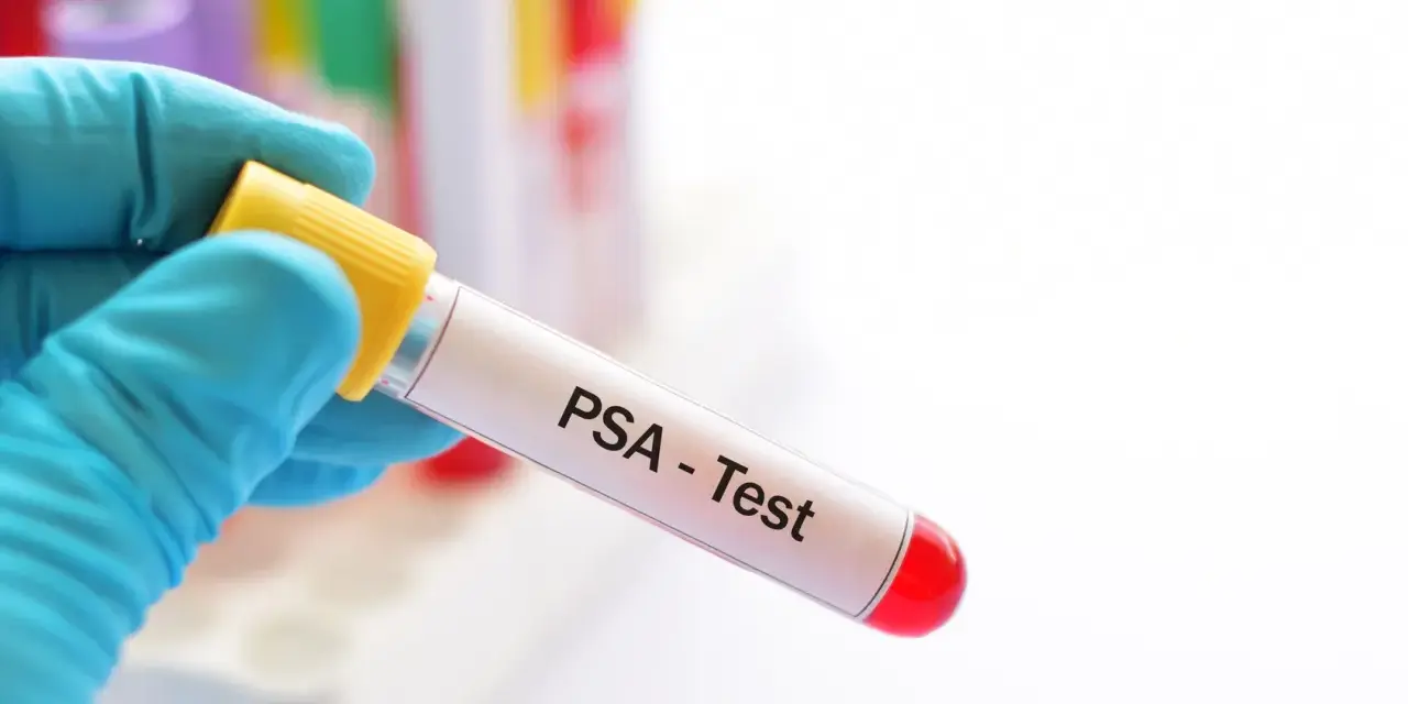 Ręka w niebieskiej rękawiczce trzyma probówkę z napisem "PSA - Test". W tle widać inne probówki.