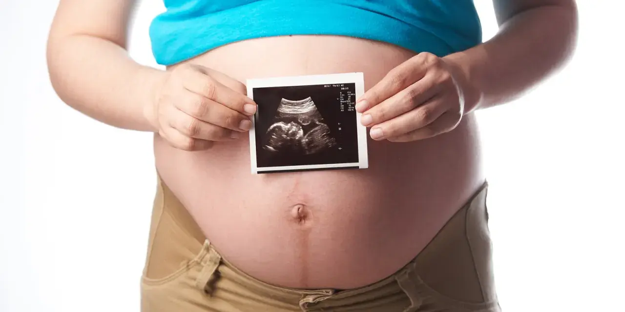 Schwanger in der 21. SSW: Ein Ultraschallbild zeigt das Baby.