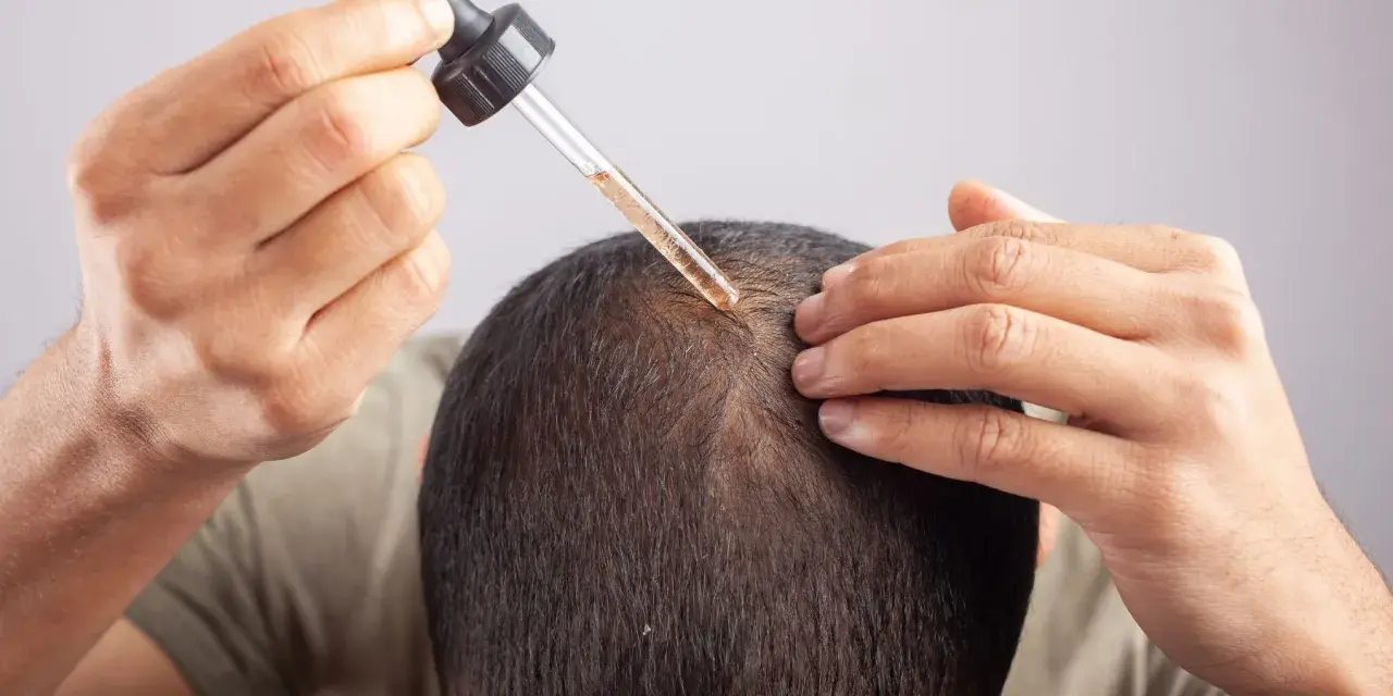 Mężczyzna aplikuje serum na skórę głowy, walcząc z przetłuszczającą się skórą głowy i problemami z włosami.