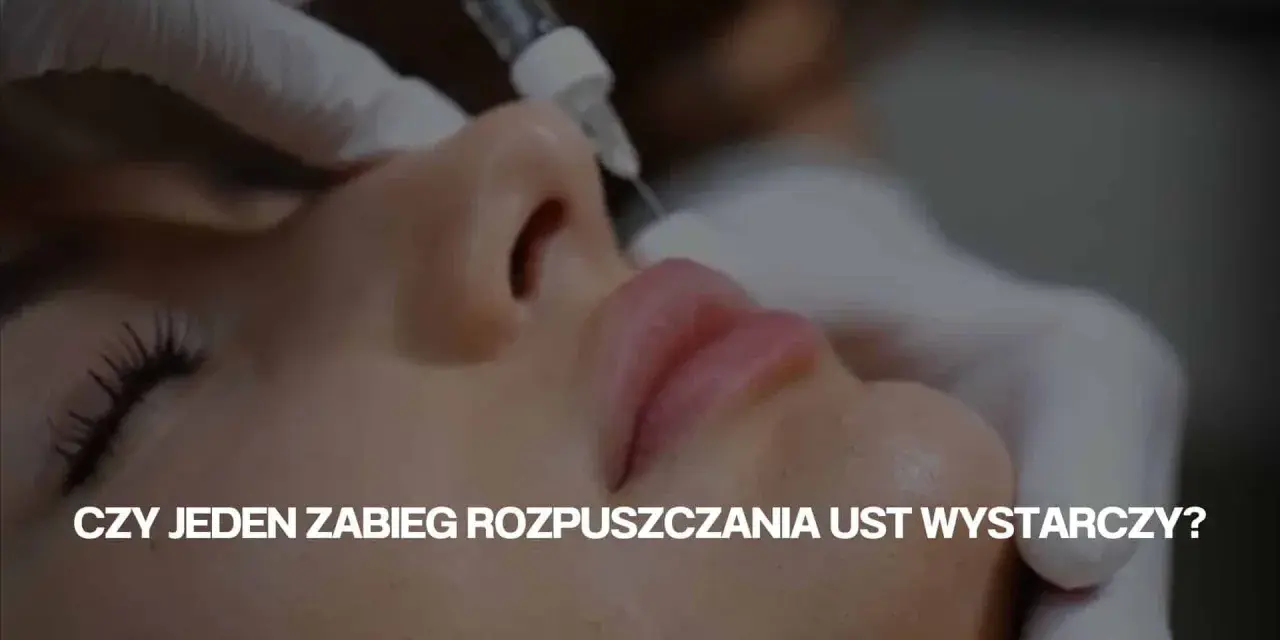 Zabieg rozpuszczania ust: igła wstrzykuje preparat, by poprawić ich kształt. Czy jeden zabieg wystarczy?