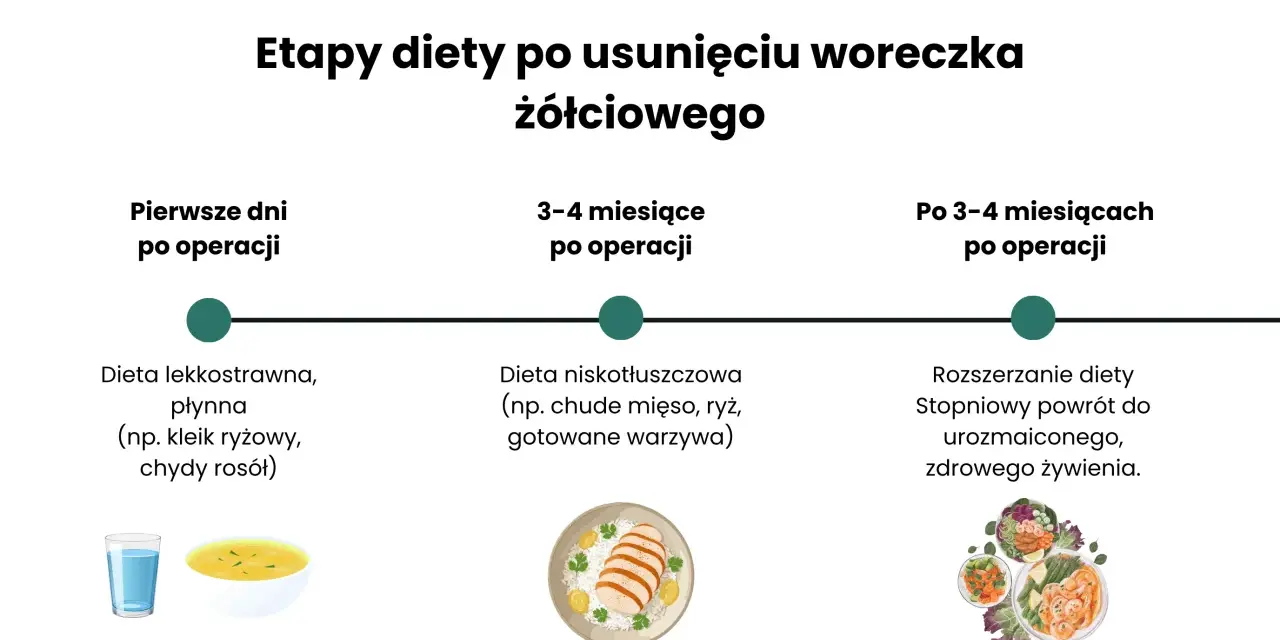 Etapy diety po usunięciu woreczka żółciowego: od płynnej, lekkostrawnej, przez niskotłuszczową, do stopniowego powrotu do zdrowego żywienia.