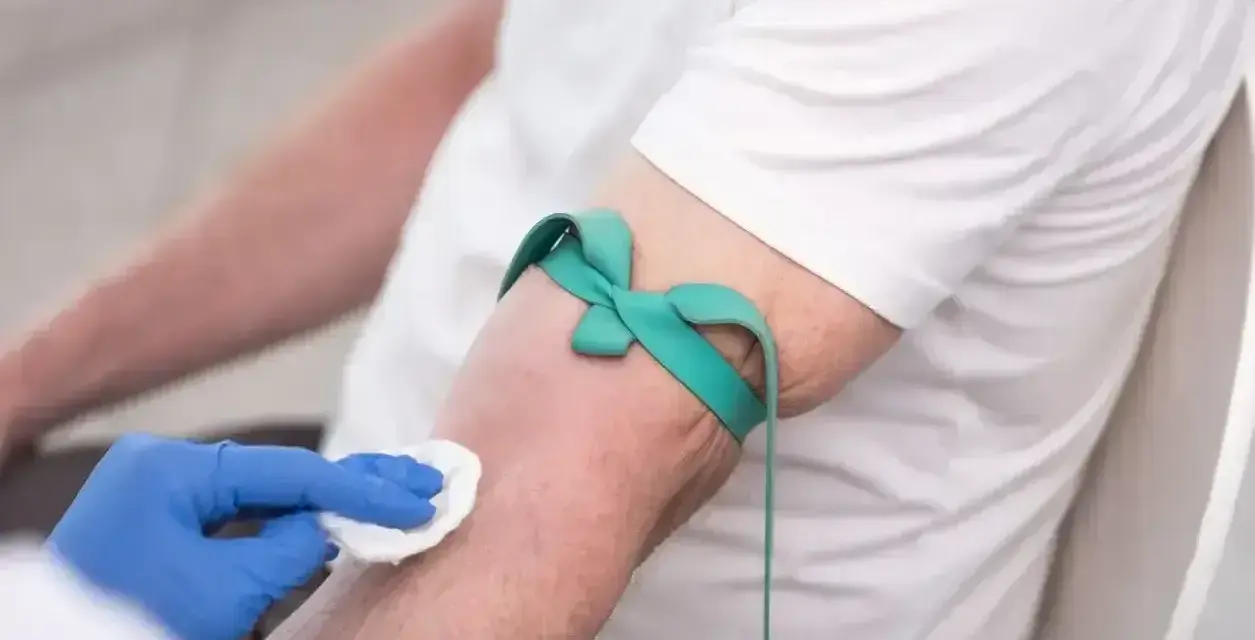 Ręka pacjenta z opaską uciskową i wacikiem przygotowywana do pobrania krwi na badanie HBs antygen.