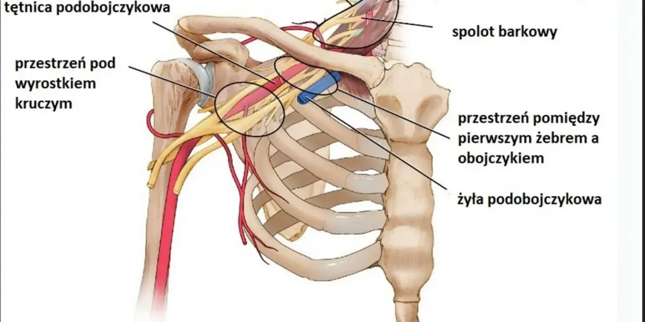 Anatomia okolicy szyjno-barkowej: tętnica i żyła podobojczykowa, mięśnie pochyłe, splot barkowy. Kluczowe dla zrozumienia zespołu szyjno barkowego.