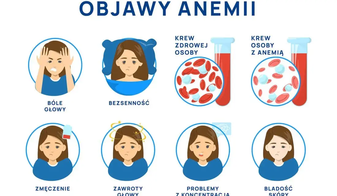 Anemia objawy psychiczne: jak niedokrwistość wpływa na twoje samopoczucie