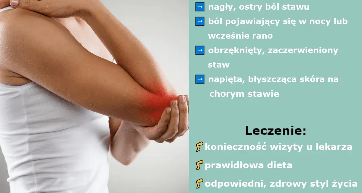 Dna moczanowa objawia się nagłym bólem stawu, obrzękiem i zaczerwienieniem. Leczenie obejmuje wizytę u lekarza, dietę i aktywność fizyczną.