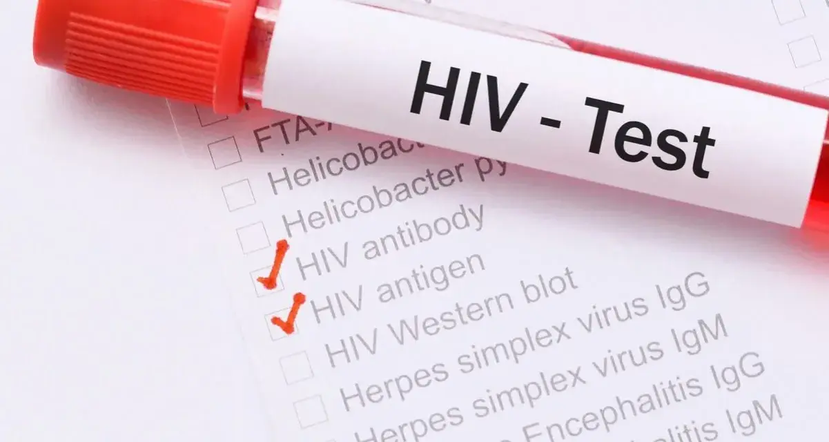 Probówka z krwią i formularz z zaznaczonymi testami na HIV.