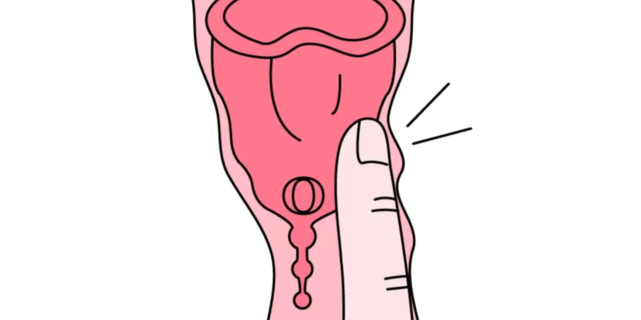 Dłoń naciska na kubeczek menstruacyjny. Tworzywo TPE, choć popularne, może budzić pytania o jego szkodliwość.