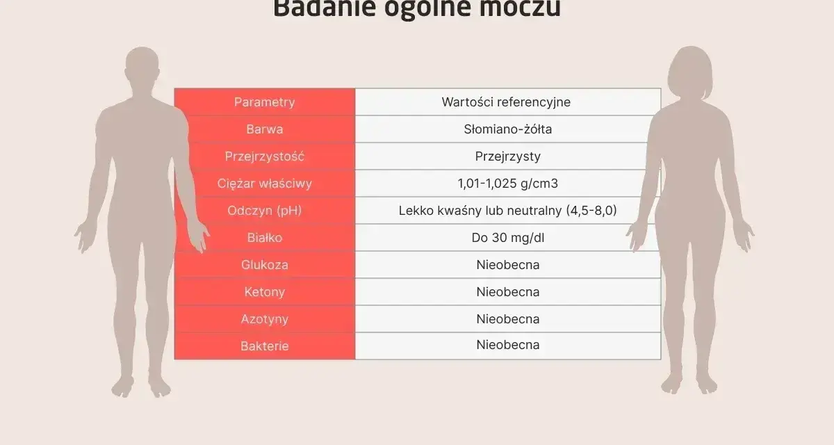 Tabela z badaniem ogólnym moczu. Wartość ciężar właściwy moczu za niski może wskazywać na problemy z nerkami.