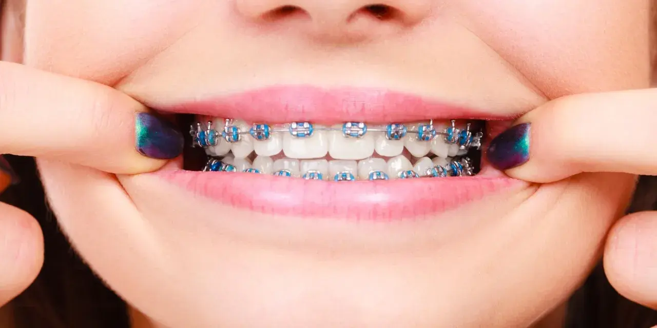 Czy ortodonta to dentysta? Poznaj kluczowe różnice i wybierz specjalistę