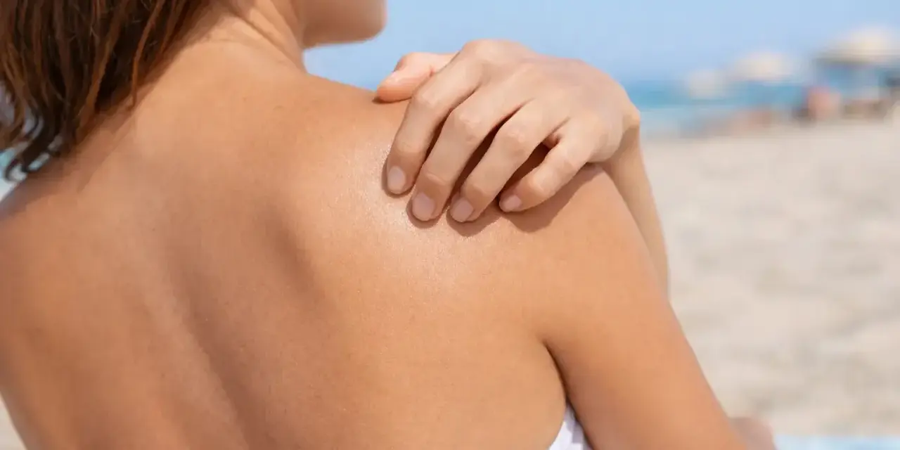 Delikatne pieczenie skóry bez widocznych zmian po opalaniu na plaży. Dłoń dotyka ramienia.