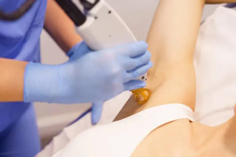 Depilacja laserowa: czy boli? Poznaj prawdę i metody łagodzenia bólu