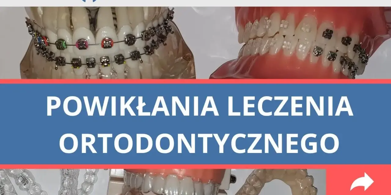 Ból zębów po aparacie? Szybka ulga i porady ortodonty!