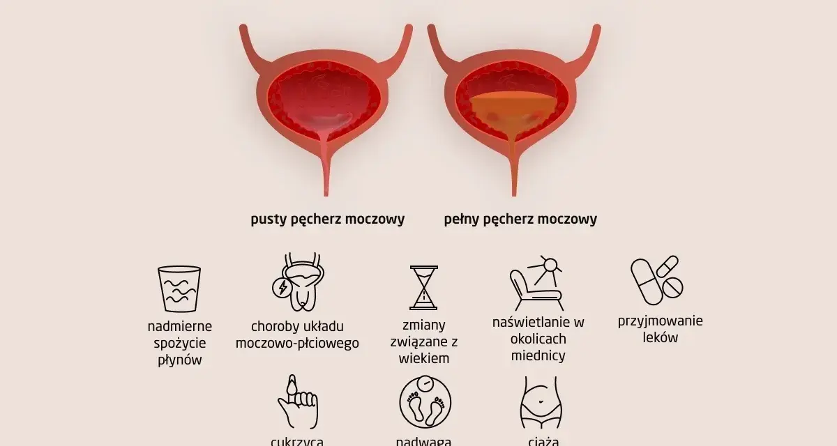 Ilustracja pokazuje przyczyny częstego oddawania moczu: nadmierne picie, choroby, wiek, nadwagę, ciążę i leki.