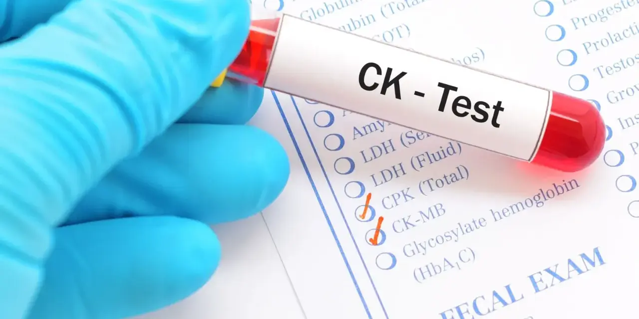 Rękawiczka trzyma probówkę z krwią do testu CK. Na formularzu zaznaczono kinazę kreatynową 400.