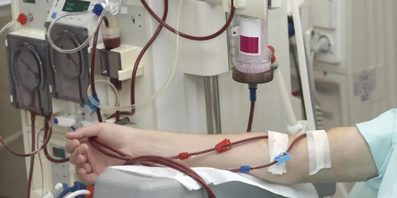 Ramię pacjenta podłączone do aparatury dializacyjnej z widocznymi przewodami i filtrem.