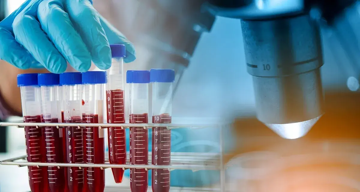 Rękawiczka laboratoryjna trzyma probówkę z krwią na tle mikroskopu.