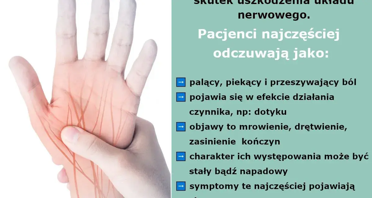 Dłoń z zaznaczonymi nerwami, ilustrująca ból neuropatyczny kręgosłupa. Odczuwany jako palący, piekący, z mrowieniem i drętwieniem.