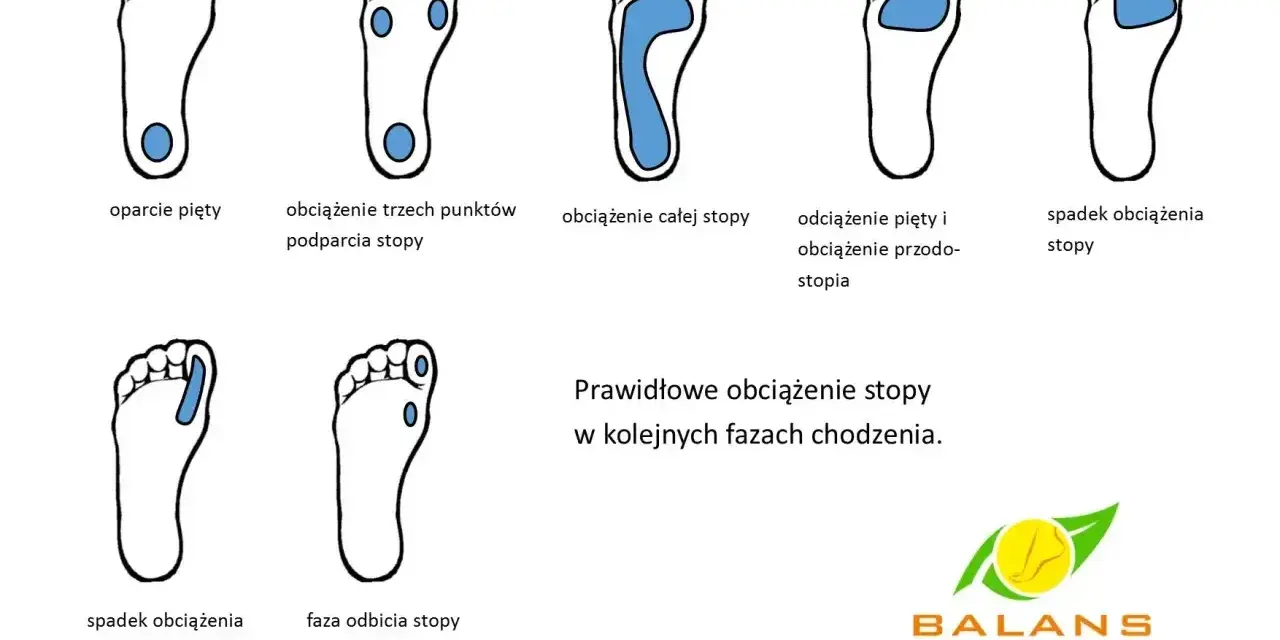 Ilustracje pokazują prawidłowe obciążenie stopy w chodzeniu, od pięty po palce. Brak prawidłowego podparcia łuku stopy może prowadzić do płaskostopie.