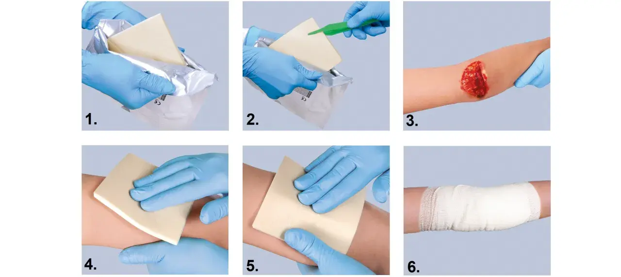 Instrukcja: opatrunek hemostatyczny jak używać. Wyjmij, przygotuj, przyłóż do rany, dociśnij, zabezpiecz bandażem.