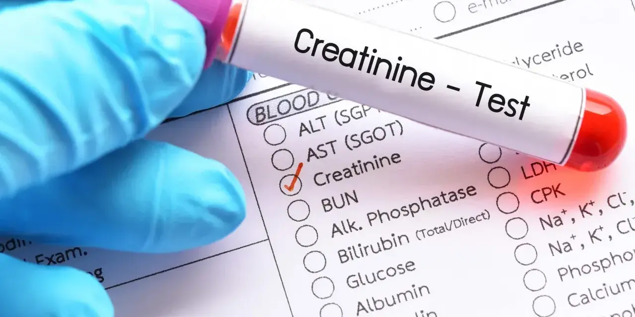 Ręka w niebieskiej rękawiczce trzyma probówkę z napisem "Creatinine - Test". Zaznaczono opcję "Creatinine" na formularzu badań.