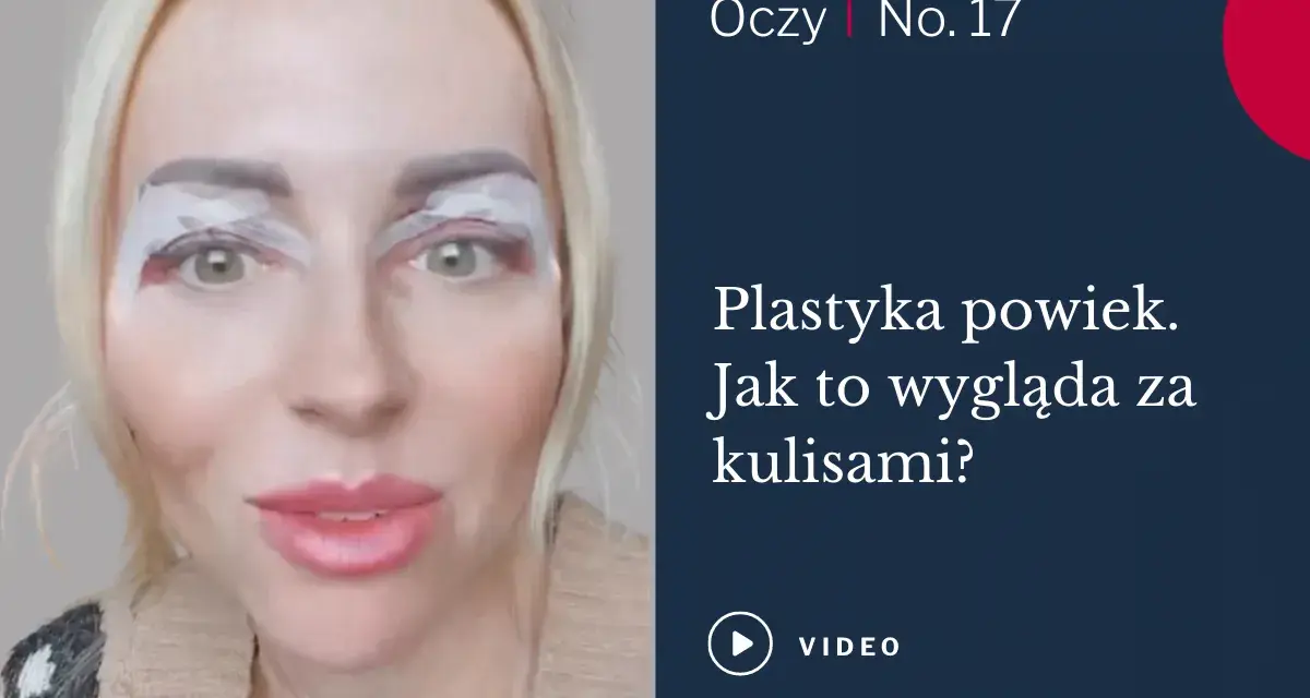Kobieta z plastrem na powiekach górnych, przygotowująca się do zabiegu korekty powiek.