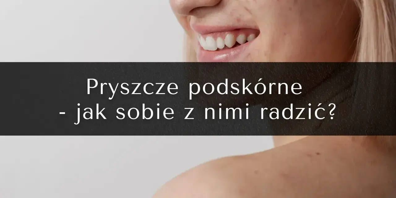 Uśmiechnięta twarz z piegami i pryszczami. Na ramionach widoczne są kolejne zmiany skórne. Tekst: "Pryszcze podskórne - jak sobie z nimi radzić?".