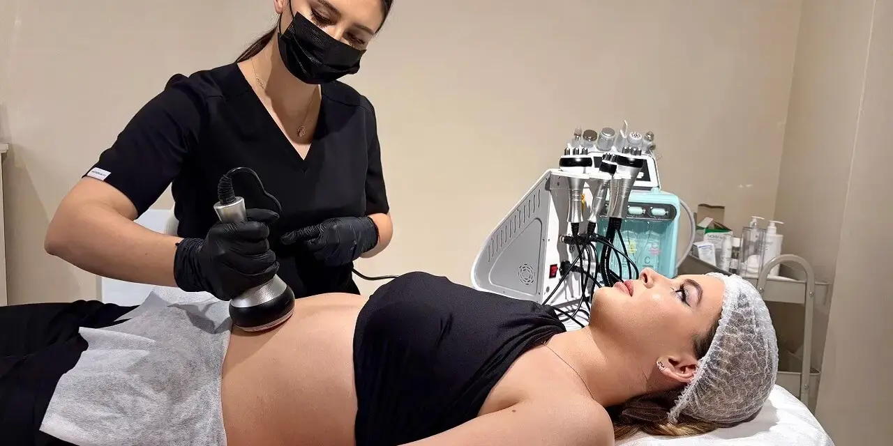 Liposukcja: Jak działa, ile kosztuje i czy jest dla Ciebie?
