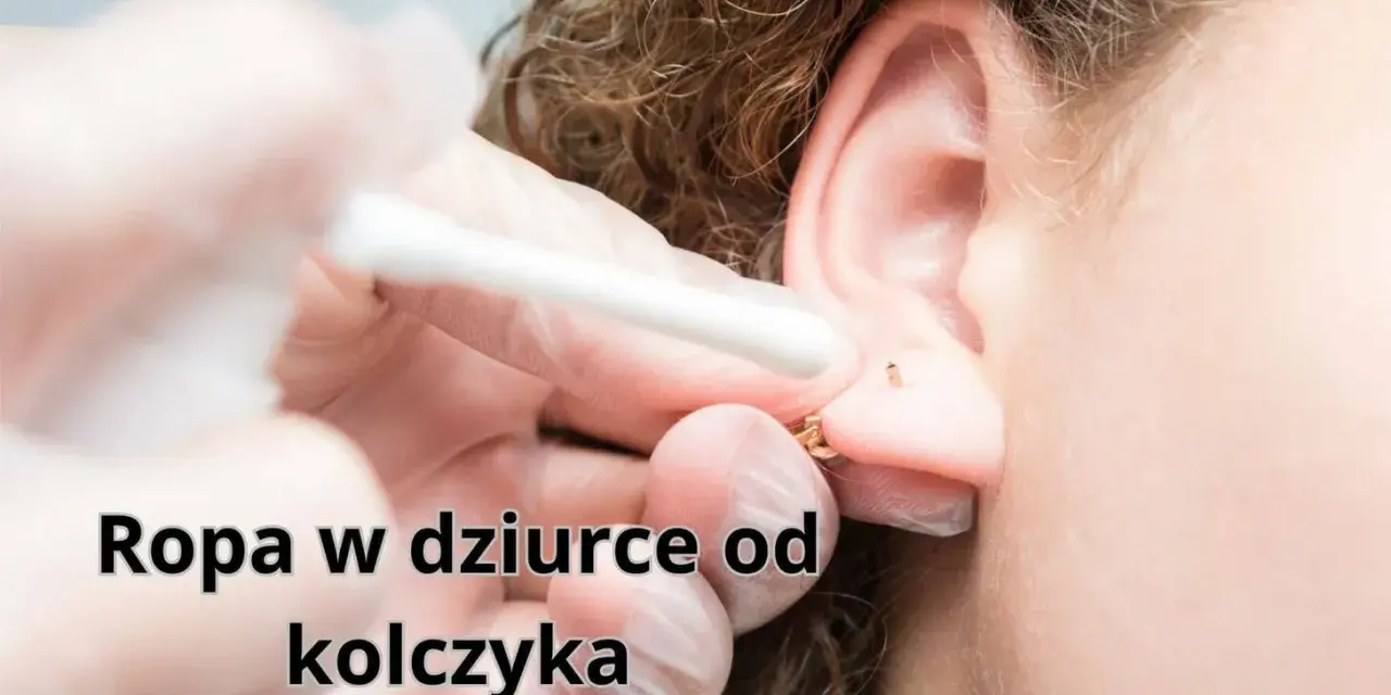 Ropa w dziurce od kolczyka, widoczna podczas czyszczenia ucha wacikiem.