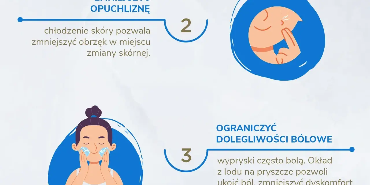 Lód na pryszcze: czy działa? Poznaj fakty i jak stosować