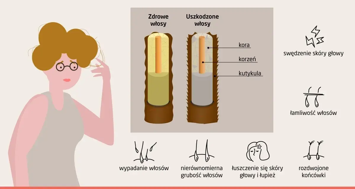 Ilustracja pokazuje objawy suchych i łamliwych włosów, w tym rozdwojone końcówki i ogólne osłabienie struktury włosa.