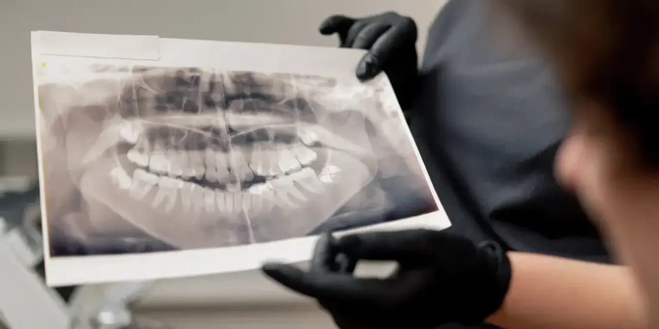 Pantomogram: Co dentysta widzi na zdjęciu? Ukryte problemy jamy ustnej