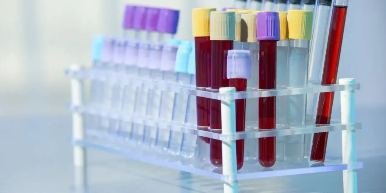 Rurki z krwią w stojaku laboratoryjnym. Czy to badanie CA 125?