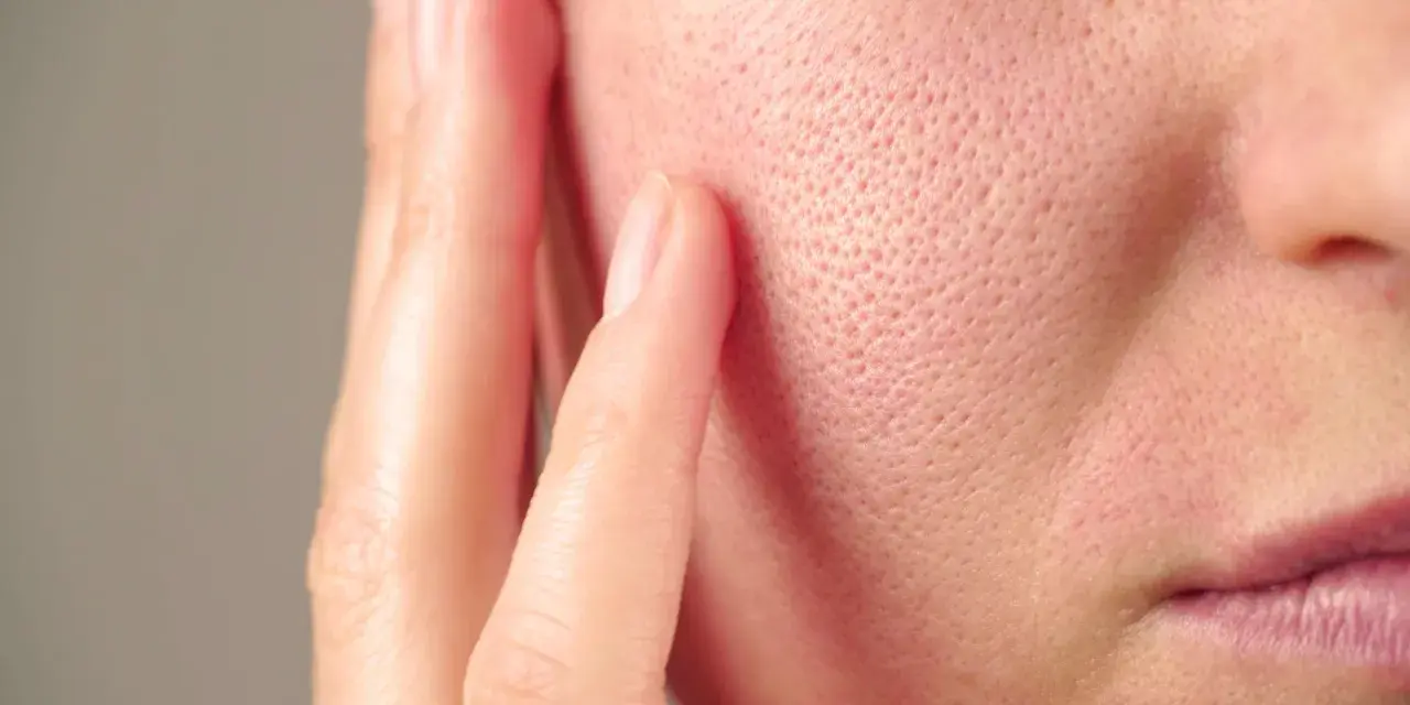 Gros plan sur une peau avec un pore dilaté visible, touchée par une main.