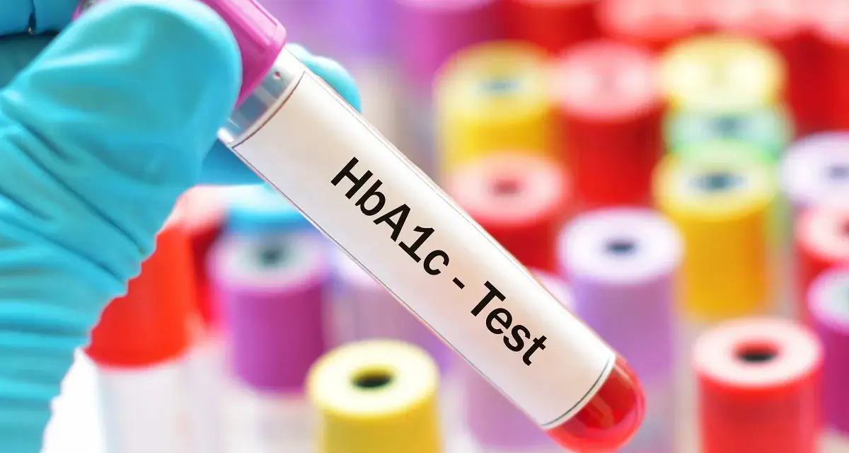 Ręka w niebieskiej rękawiczce trzyma probówkę z napisem "HbA1c - Test". W tle kolorowe probówki. Sprawdź, jaka jest hemoglobina glikowana cena.