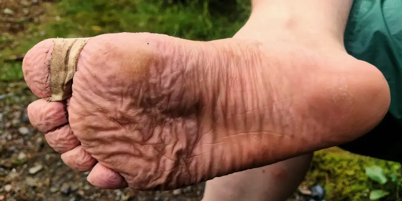 Fuß mit Blasenpflaster am Zeh, um Blasen vorzubeugen. Die Haut ist zerknittert vom Wandern.