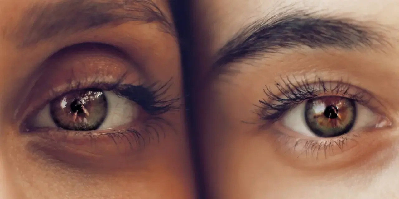 Dos ojos de cerca, uno con ojeras vasculares marcadas, el otro con piel lisa. Reflejos en los iris.