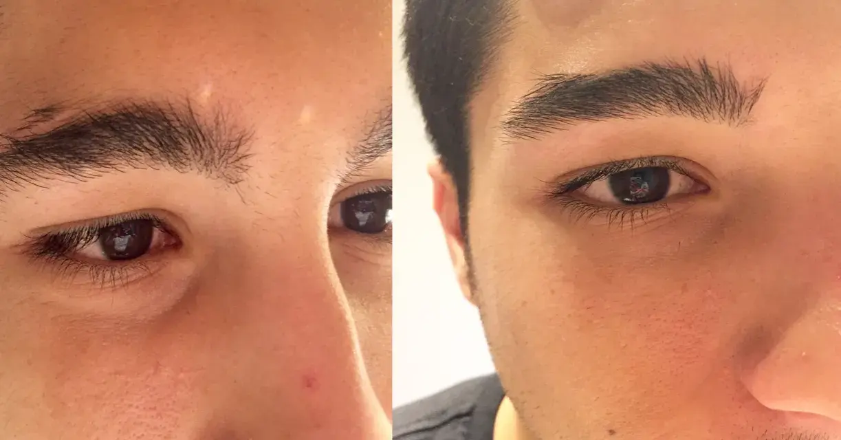 Antes y después de hacerse las cejas hombre. Las cejas se ven más definidas y limpias.