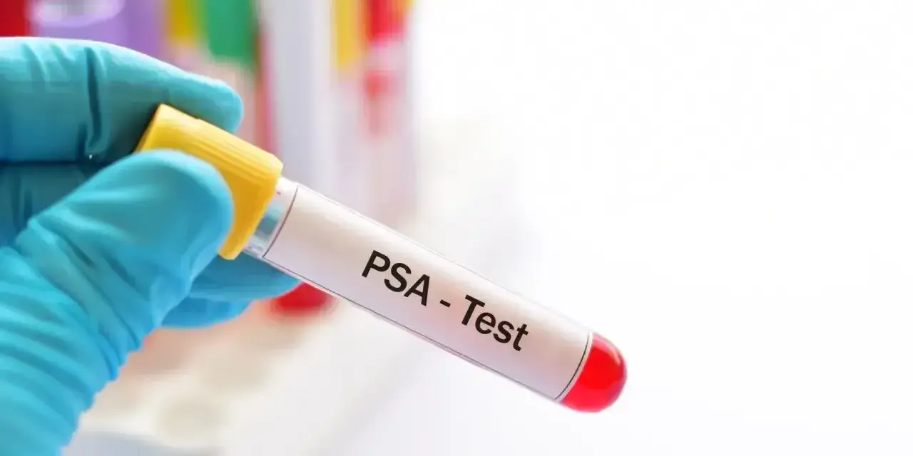 Rękawiczka trzyma probówkę z napisem "PSA - Test". To badanie psa, które pozwala ocenić jego stan zdrowia.